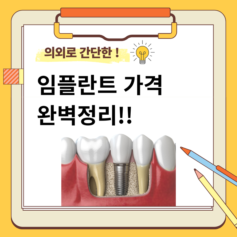 임플란트 가격 완벽정리