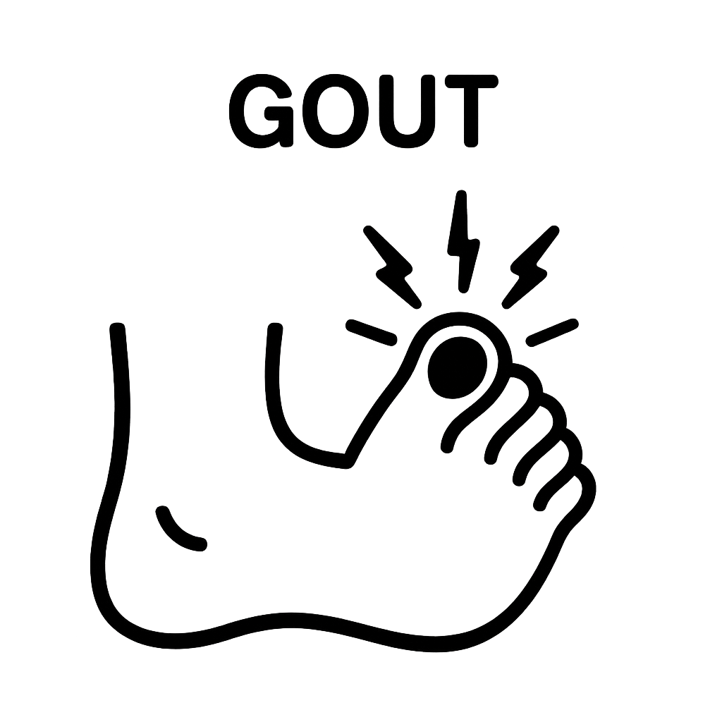 통풍에 관한 사진