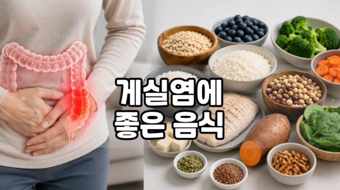 게실염에 좋은 음식