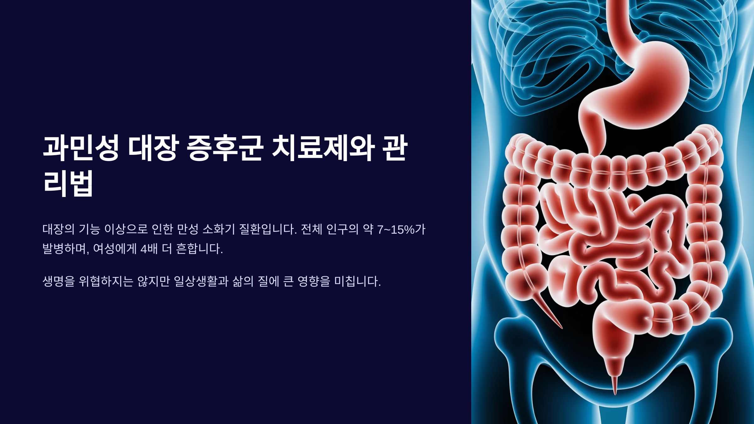 과민성 대장 증후군 치료제