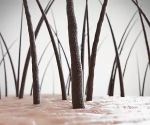 두피 가려움증 원인