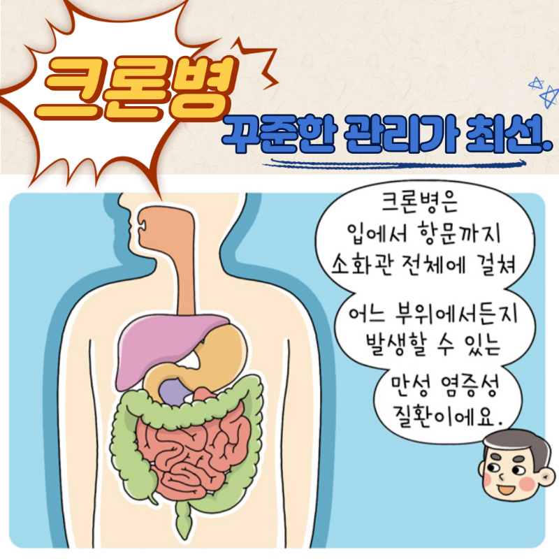 크론병