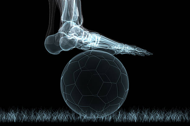 sports fractures