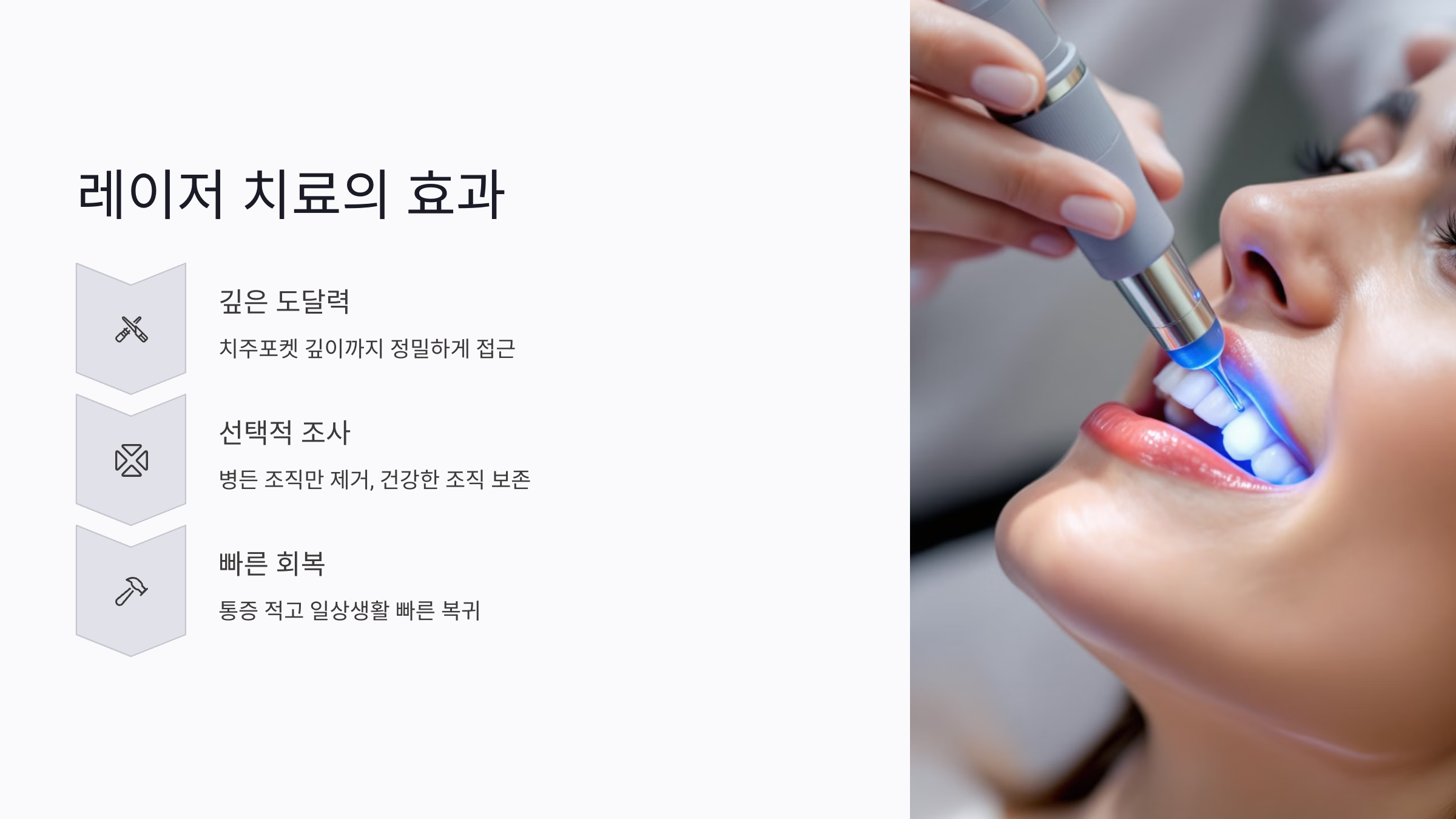 약물이 닿지 않는 잇몸 속까지 치료하는 레이저의 힘