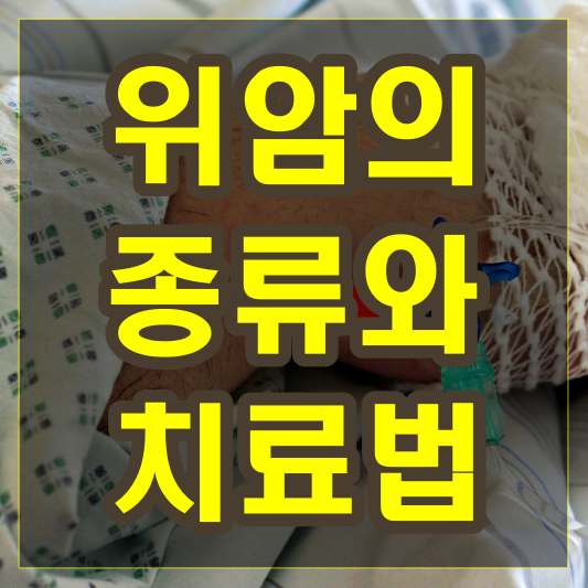 위암 종류와 치료법