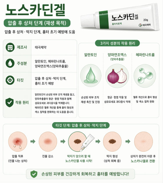 노스카딘겔 사용법 인포그래픽으로 여드름 압출 후 상처 단계, 딱지 관리, 흉터 예방 효과와 알란토인, 헤파린나트륨, 양파추출물 성분 작용을 정리한 이미지