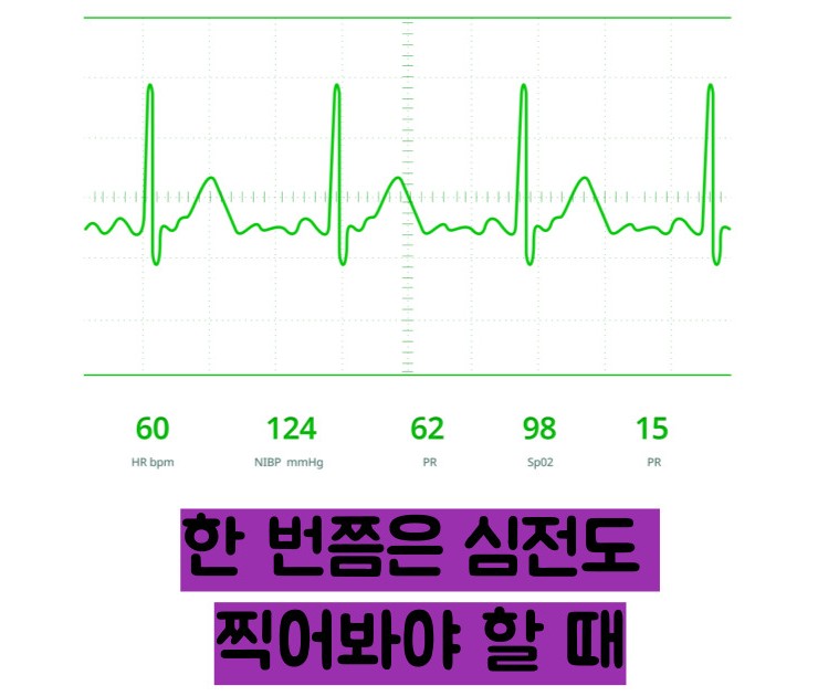 부정맥 증상