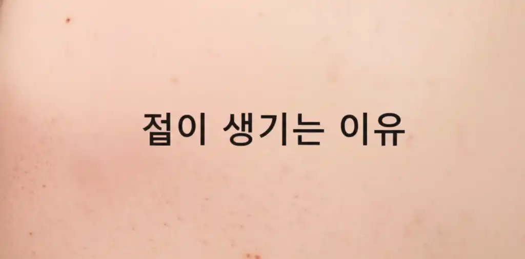 점이생기는이유_썸네일