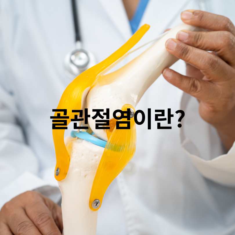 40대 이후 꼭 알아야 할 골관절염 증상 완화 방법