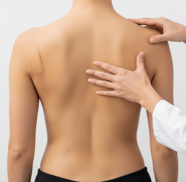 척추 측만증 증상과 원인 완벽 정리6