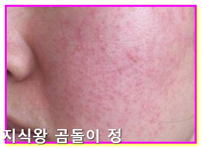 갱년기 관절통 수면장애 줄이는 하루 5단계 루틴 공개1