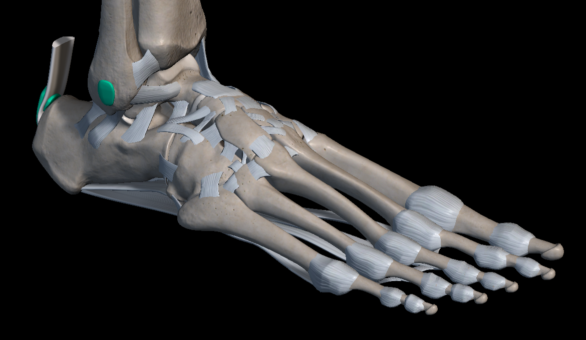 발목 염좌 증상