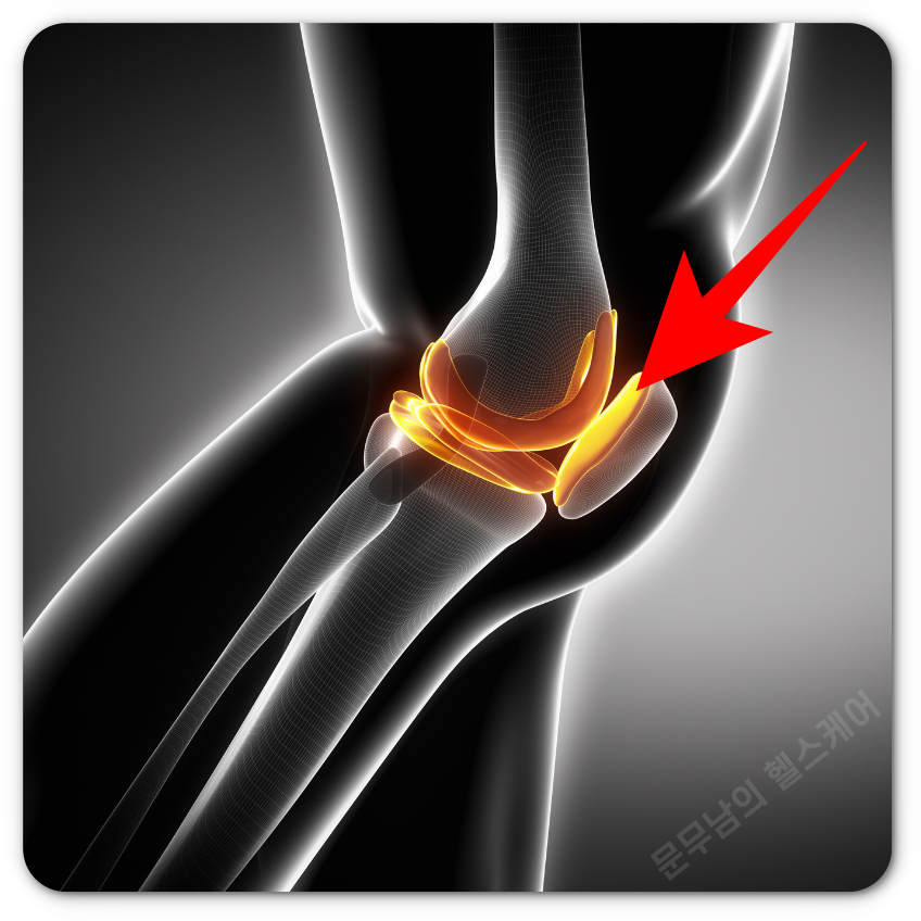 무릎 통증 원인 7가지 총정리