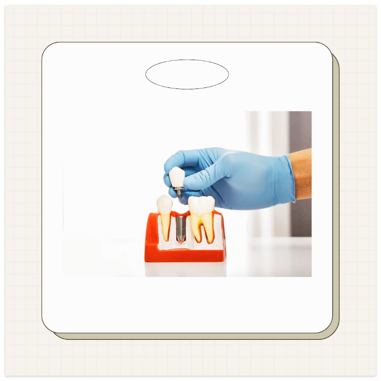 대전 임플란트 지원금