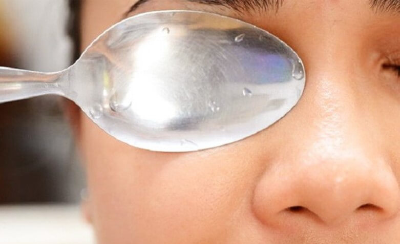 냉동-숟가락-눈붓기-뺄때