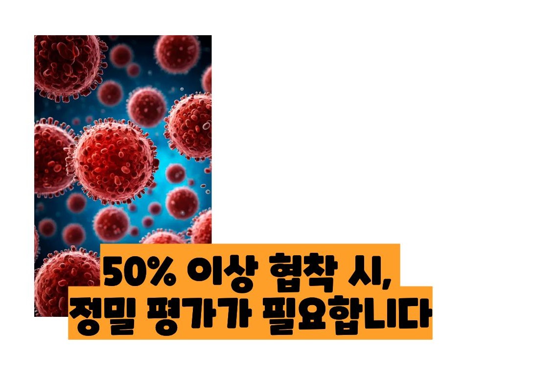 경동맥 협착증 치료