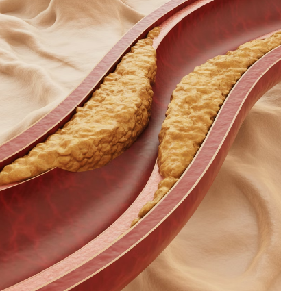 콜레스테롤 정상수치