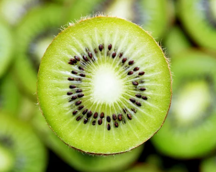 키위 효능 10가지 부작용 알고 먹자!