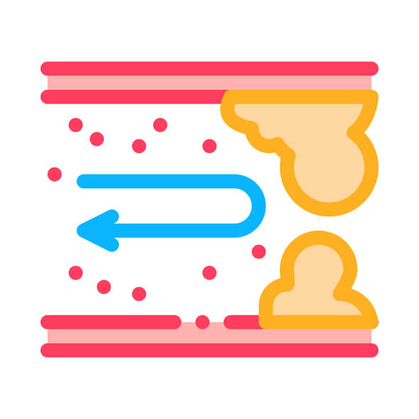 퀘르세틴 양파껍질 효능