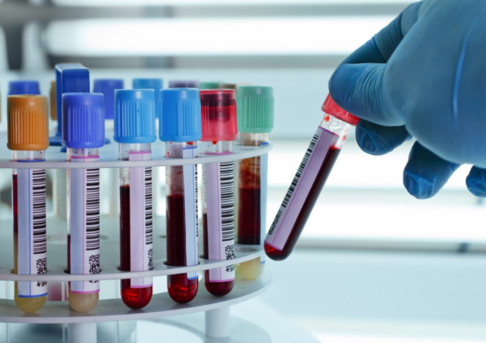 STD 12종 성병 검사