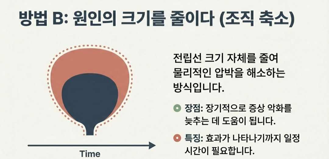 전립선비대증치료-사진6