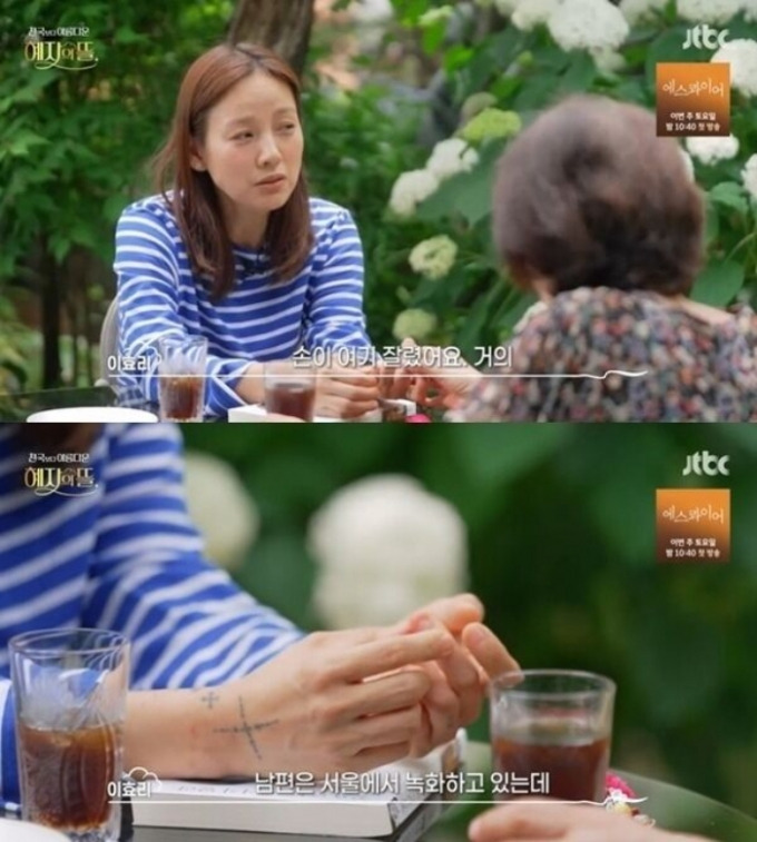 이효리 개물림 사고