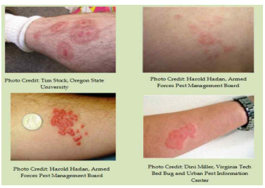 빈대 퇴치방법, 대응방안