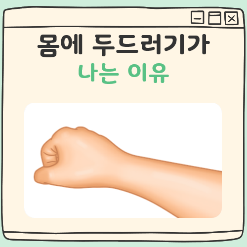 몸에 두드러기가 나는 이유 대표 이미지