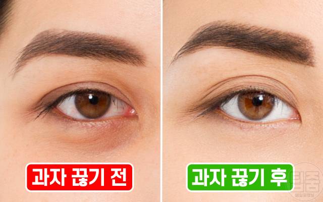 과자 끊기 효과 한달 후 수면 다크서클