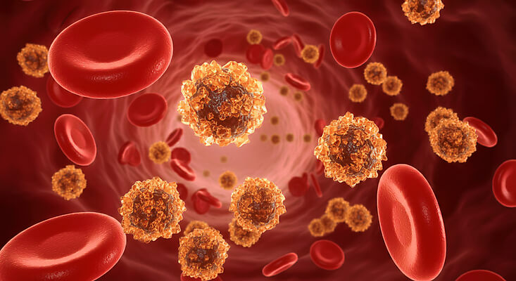혈당스파이크 증상