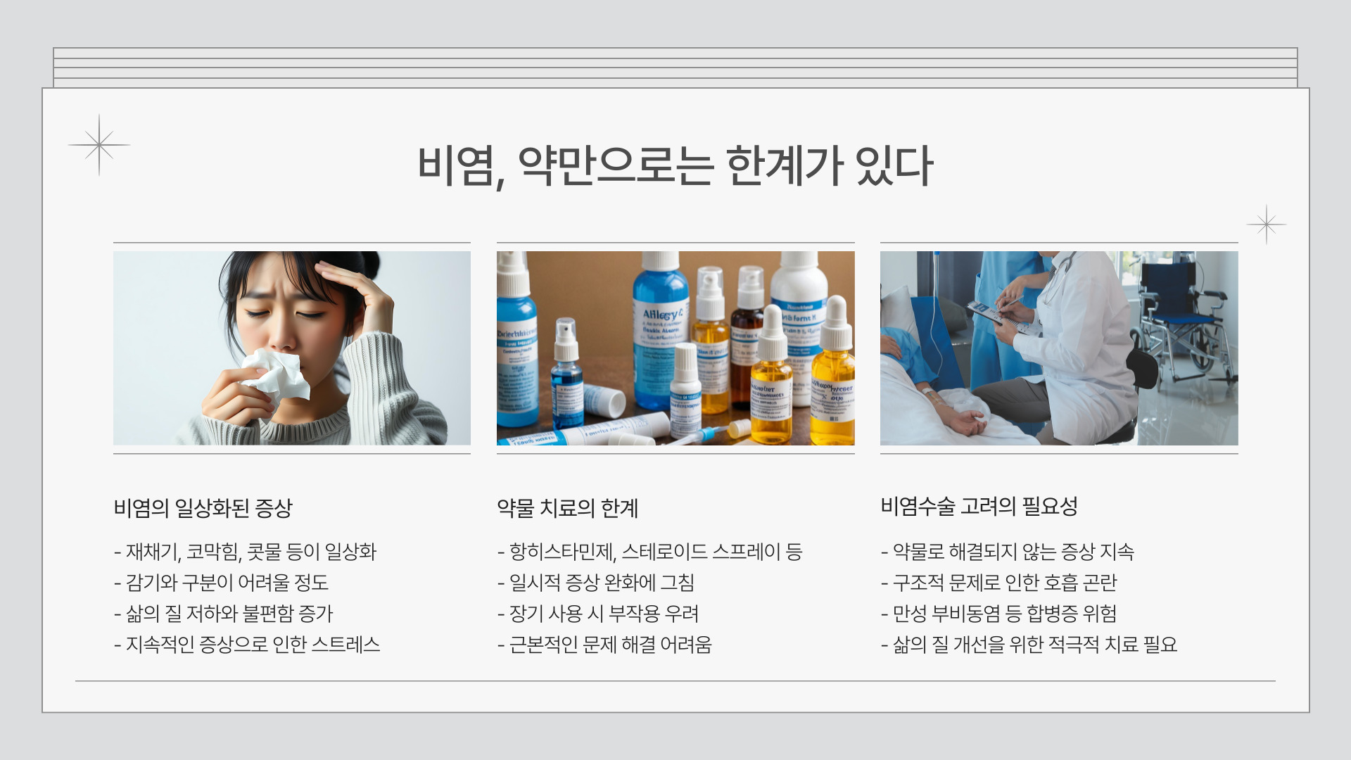 비염수술