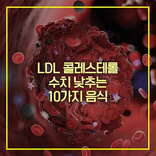 LDL 콜레스테롤 수치 낮추는 음식 10가지