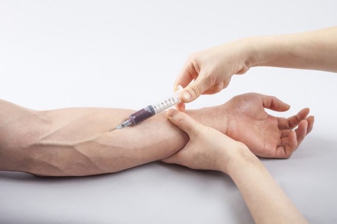 LDH 수치가 높으면