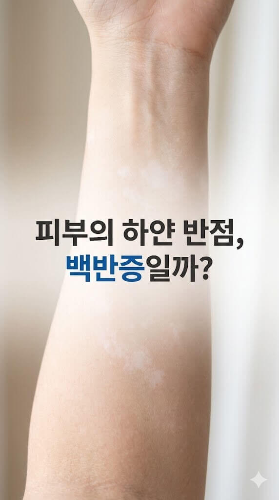 팔뚝에 보이는 하얀 반점 백반증을 앓고 있는 모습