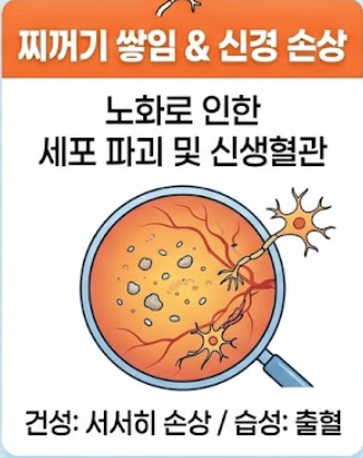 황반변성 치료법