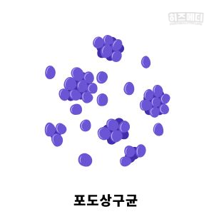 다래끼 원인