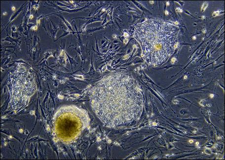 줄기세포 치료의 현실 (규제 한계, 효능 오해, 선택 기준)