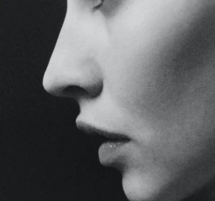 구안와사 전조증상