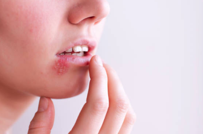 대상포진 증상, 전염, 치료방법 총정리 (2024ver)