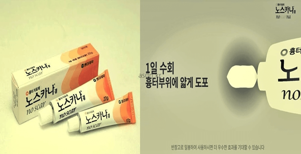 노스카나겔 효능 효과,성분,가격,부작용 총정리