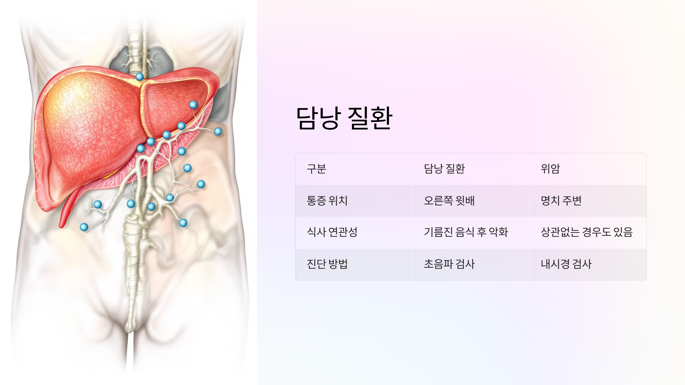 담낭 질환