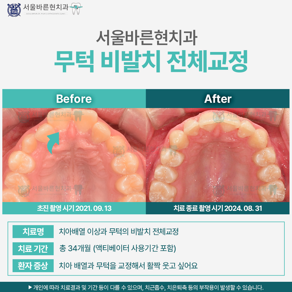 해운대교정치과