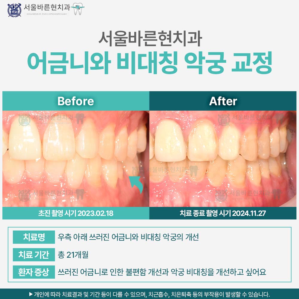 해운대교정치과