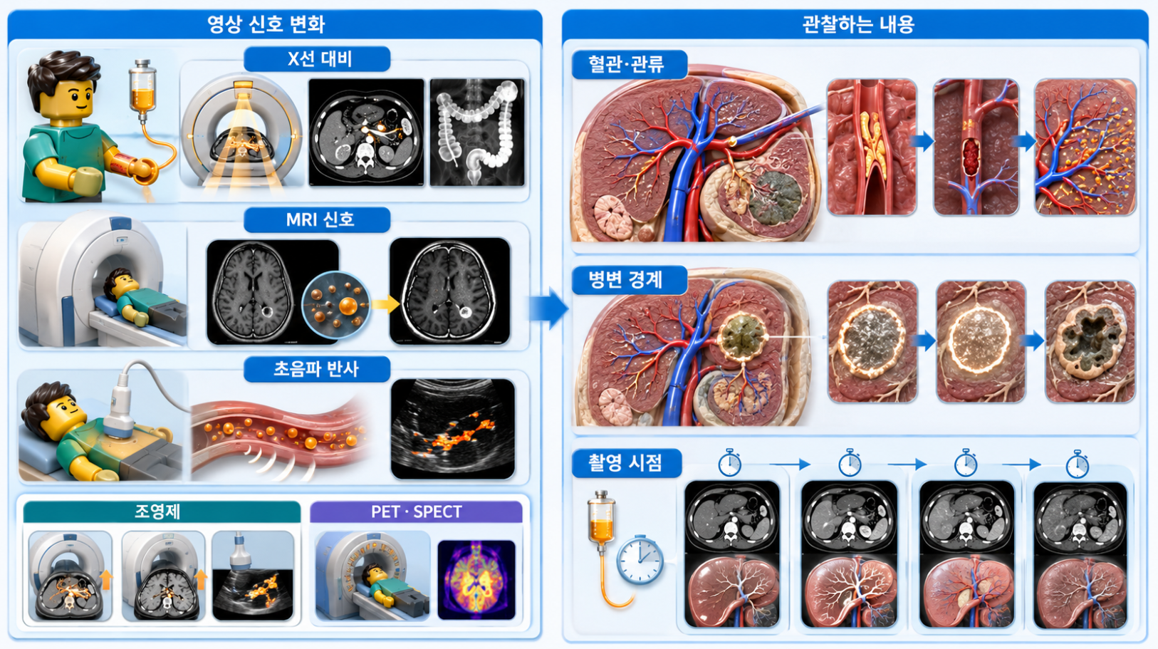 조영제가 CT·MRI·초음파 영상 신호를 바꾸는 원리와 혈관·관류·병변 경계·촬영 시점 비교