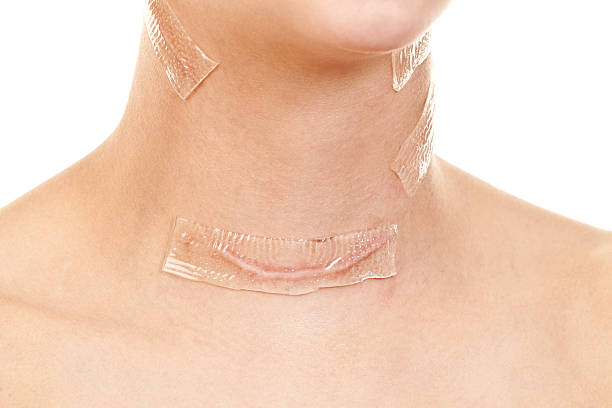 가장 전통적인 방법으로 목 앞쪽을 절개하여 혹을 직접 제거하는 방식