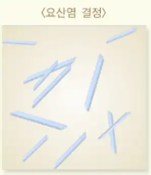 요산염결졍-이미지