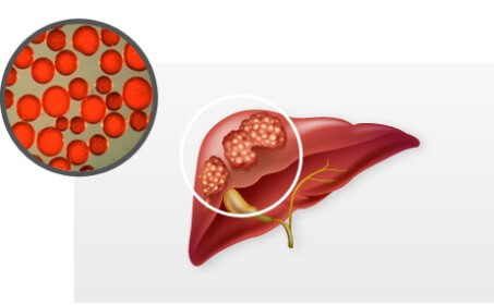 넥스트바이오메디컬 공모주 청약