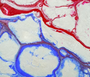 혈액순환 장애 증상 대처법