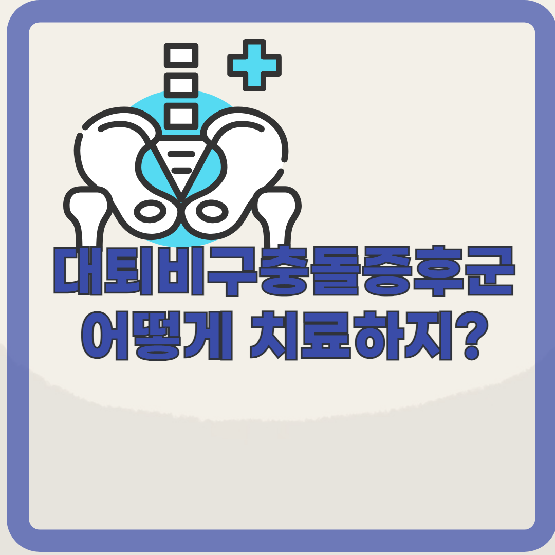 고관절 통증의 주범, 대퇴비구충돌증후군(고관절충돌증후군) 바로 알기