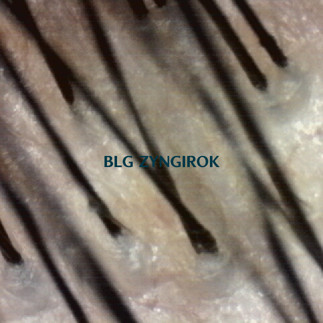 탈모 극복 프로젝트 - 뒷머리 두피 사진 모습이다.